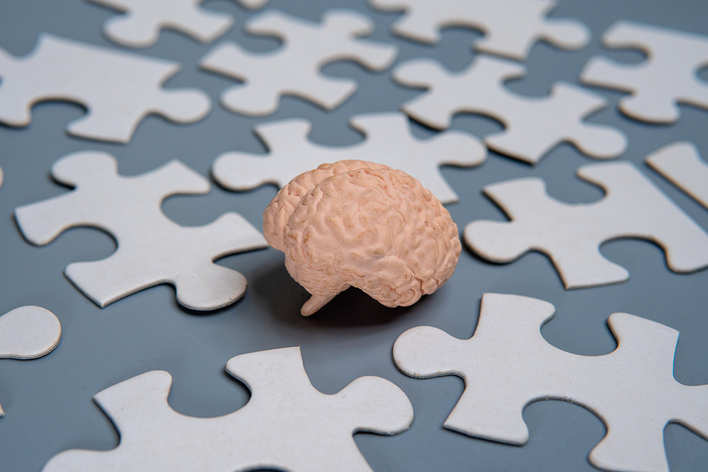 I’ve been studying the brain for 15 years. If you do just one thing for sharper memory, make it this Featured Image